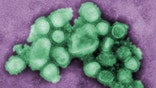 At least one in five people worldwide were infected with swine flu during the first year of the - HN pandemic, an international research group said on Friday, but the death rate was just . percent